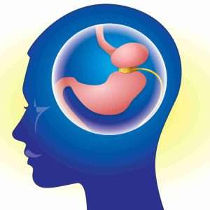 Hypno-Gastric-Band